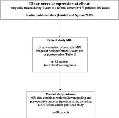 Patients having surgery for ulnar nerve compression at the elbow rarely have affection of the spinal nerve root at C8-Th1 levels